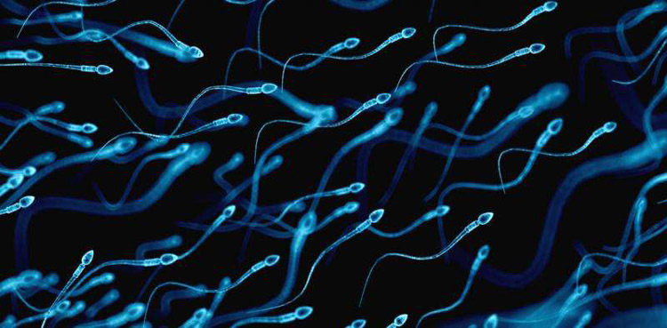 اسپرم ضعیف و تعداد کم اسپرم ها از مشکلات ناباروری