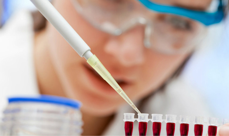 آزمایش QF-PCR برای تشخیص اختلالات کروموزومی