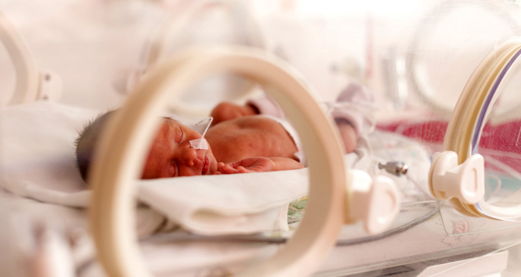کامل نشدن ریه نوزاد، زایمان زودرس، نوزاد زیر دستگاه در بیمارستان