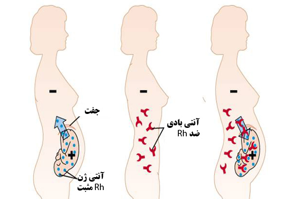 نحوه عملکرد آمپول روگام