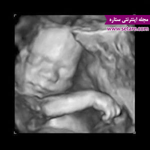بارداری هفته به هفته - هفته های بارداری