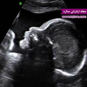 بارداری هفته به هفته - هفته های بارداری