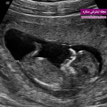 هفته های بارداری - بارداری هفته به هفته