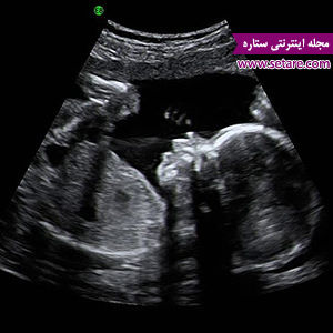 هفته بیست و سوم بارداری - بارداری هفته به هفته - هفته های بارداری هفته بیست و سوم بارداری - بارداری هفته به هفته - هفته های بارداری