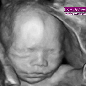 هفته بیست و دوم بارداری - بارداری هفته به هفته - هفته های بارداری
