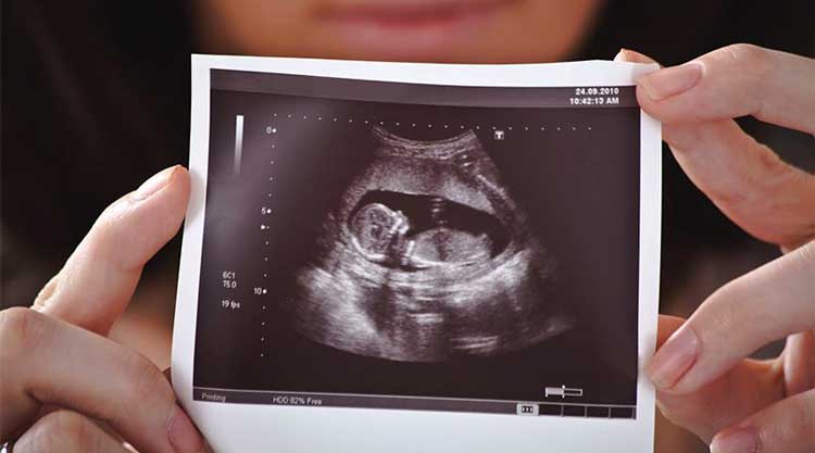 محاسبه سن بارداری، سونوگرافی و اندازه جنین