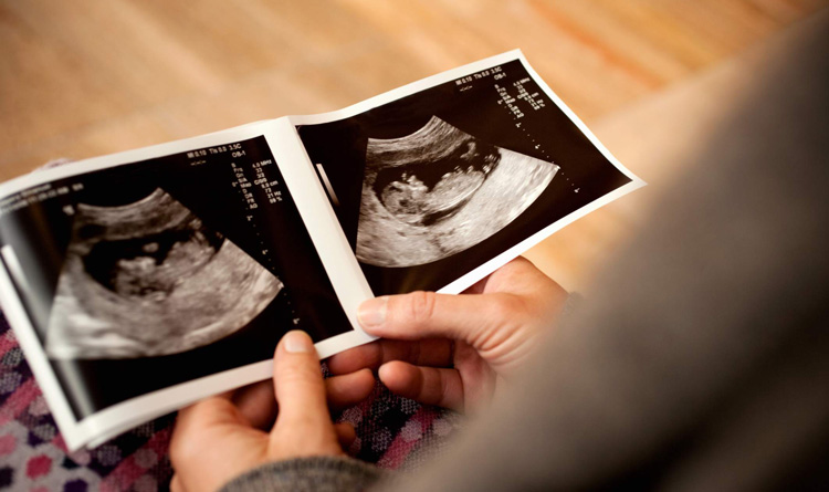 سونوگرافی و تعیین جنسیت جنین
