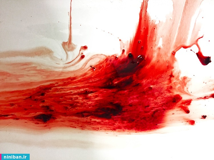 خروج لخته خون از واژن، قبل از پریود