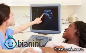 سونوگرافی بارداری