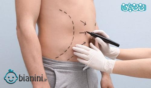 بهترین جراح زیبایی شکم و پهلو در تهران کیست؟