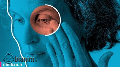 تیروئید چشمی چیست؟ آیا درمانی دارد؟