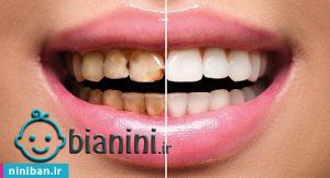 دندانپزشک ترمیمی خوب در تهران