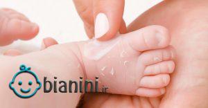 علت خشکی پوست نوزادان چیست؟