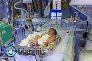 یک کودک از هر ۱۰۰۰ تولد دچار کم کاری تیروئید می شود