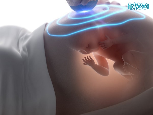 سونوگرافی آنومالی در بارداری، زمان انجام