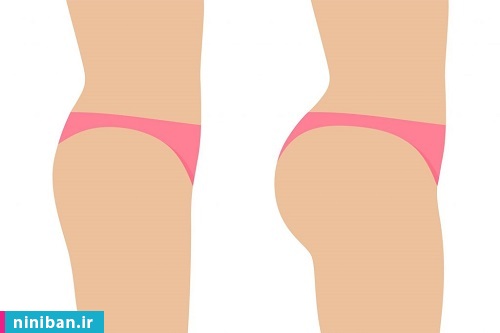 آنچه باید در مورد تزریق چربی به باسن بدانید! مزایای تزریق چربی به باسن