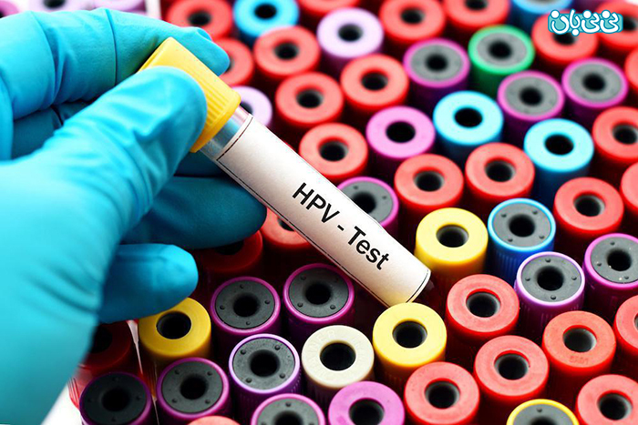 انجام آزمایش HPV، چه نمونه ای مناسب است؟