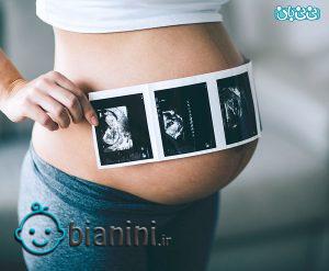 سونوگرافی آنومالی در بارداری، زمان انجام