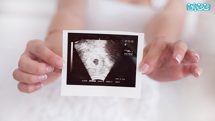 سونوگرافی های دوران بارداری، بهترین زمان انجام
