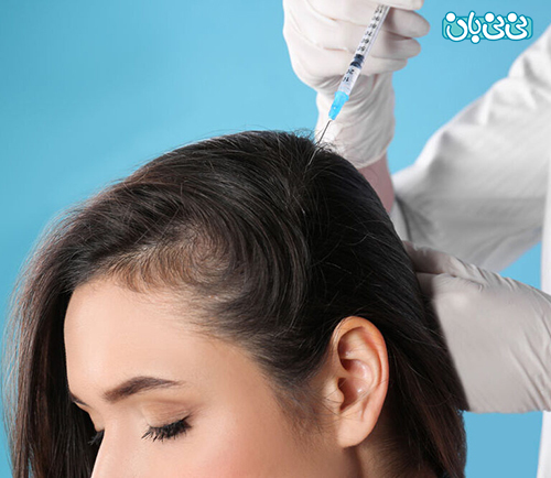 مزوتراپی مو درمان قطعی ریزش موی سر