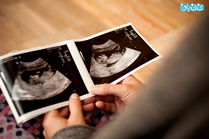 تشخیص ناهنجاری های جنین، با سونوگرافی ان تی