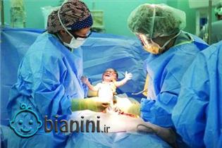 درد دل‌های مامان/ اضطراب روز زایمانم را فراموش نمی‌کنم