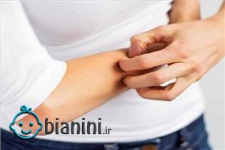 چرا تنم می‌خارد؟/ علت یک مشکل شایع بارداری