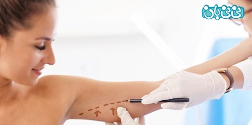 بهترین جراح بازو یا براکیوپلاستی در تهران کیست؟