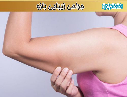 بهترین جراح بازو یا براکیوپلاستی در تهران کیست؟