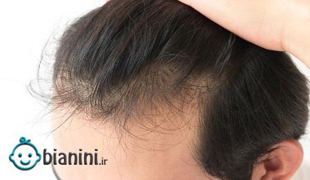 ترمیم مو به روش تار به تار یا HRP چیست؟