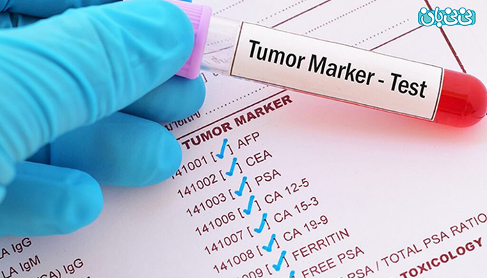 تومور مارکر در سرطان سینه، چه نقشی دارد؟