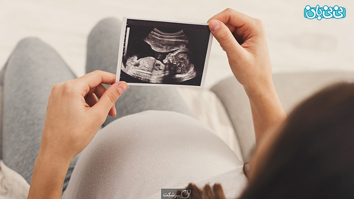 سونوگرافی دوران بارداری، چه تعدادش ضروری است؟