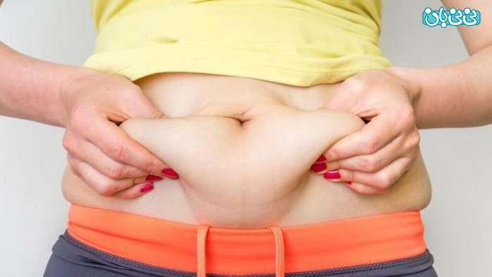عمل آبدومینوپلاستی شکم، چه مشکلاتی را درمان میکند؟