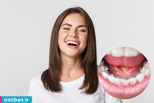 ارتودنسی از پشت دندان چیست