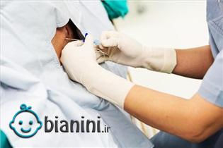 بهترین روش بیهوشی زایمان کدام است؟