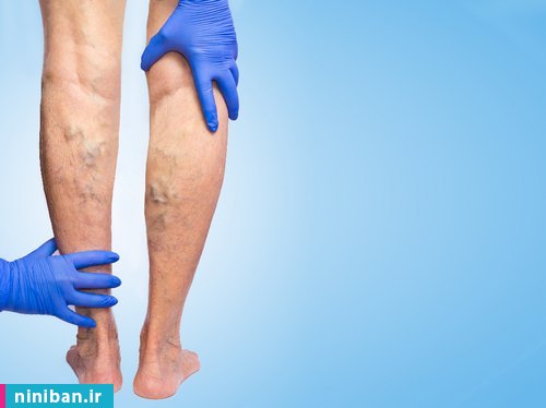 قیمت عمل افزایش قد