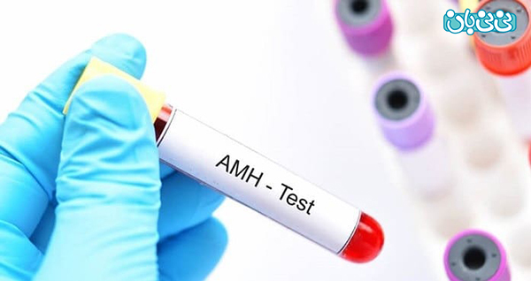 کاندید انجام آزمایش AMH کاندید انجام آزمایش AMH