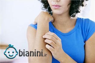 از خارش پوست در دوران بارداری چه می دانید؟