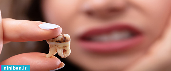 روش های  موثر در جلوگیری از پوسیدگی دندان