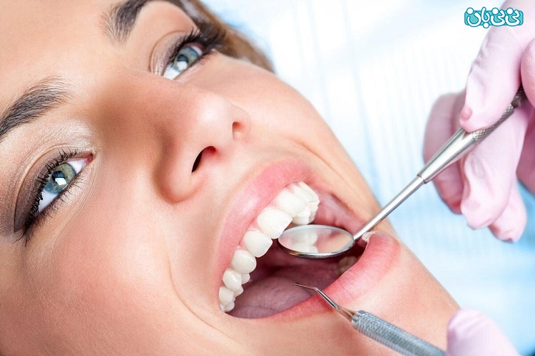 پر کردن دندان با مواد سفید، درخشندگی دندان‌هایت