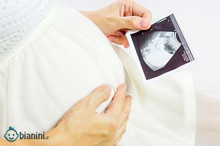7 توصیه برای داشتن نوزاد باهوش و سالم در بارداری