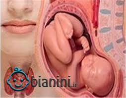 ناهنجاری تیروئید رشد مغزی جنین را مختل می کند