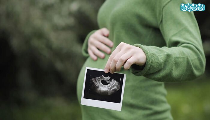 روش های تعیین جنسیت قبل از بارداری