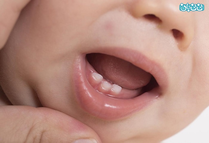 علائم دندان در آوردن کوذک