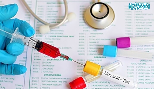 اهمیت اندازه گیری اسید اوریک در آزمایش خون