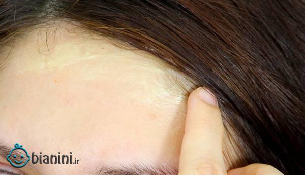 چند ترفند برای جلوگیری از لکه های رنگ مو روی پوست