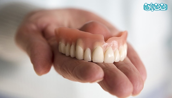 کاربرد روکش پروتز ثابت دندان