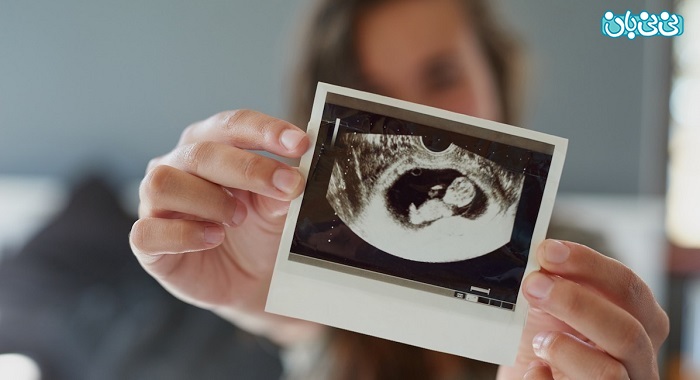 جفت جنین سقط شده چه شکلی است؟