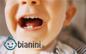 تاثیر دوران بارداری در سلامت دندان کودک