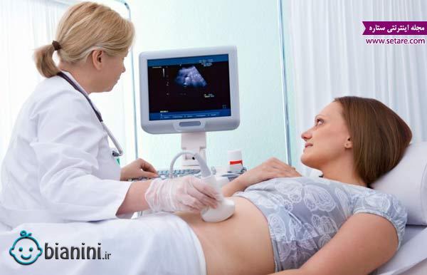 عکس سونوگرافی بارداری - محاسبه سن بارداری - اصطلاحات سونوگرافی بارداری
